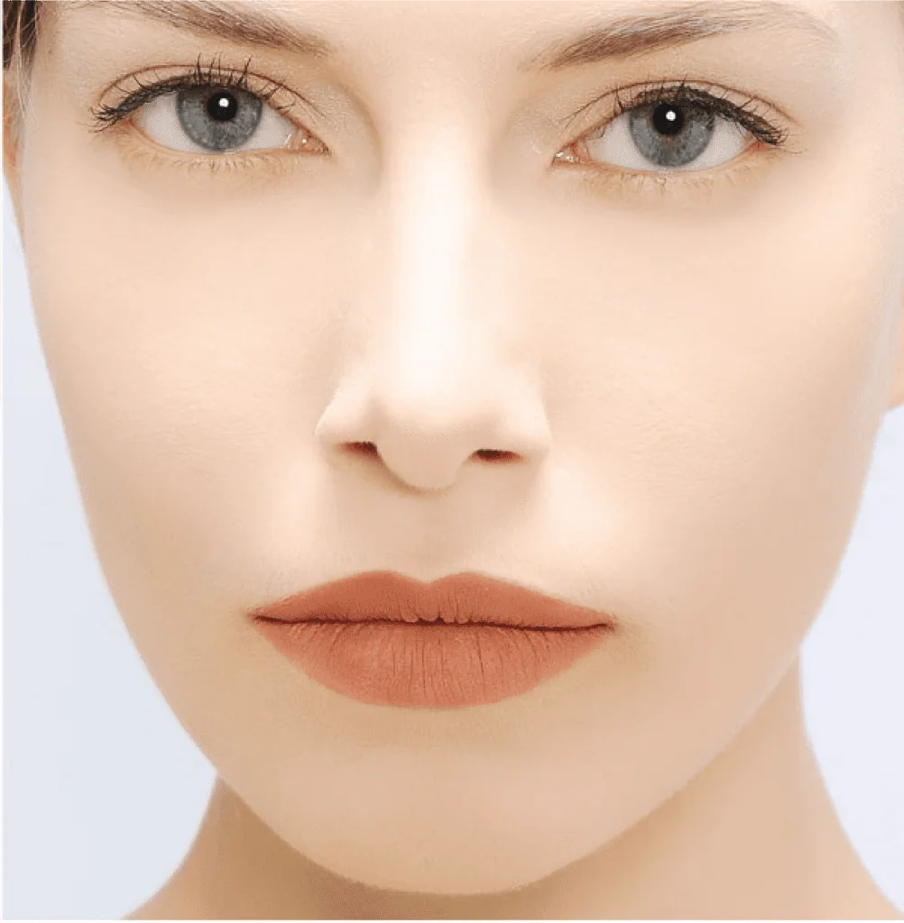 Lip Filler Transformation in Worcestershire